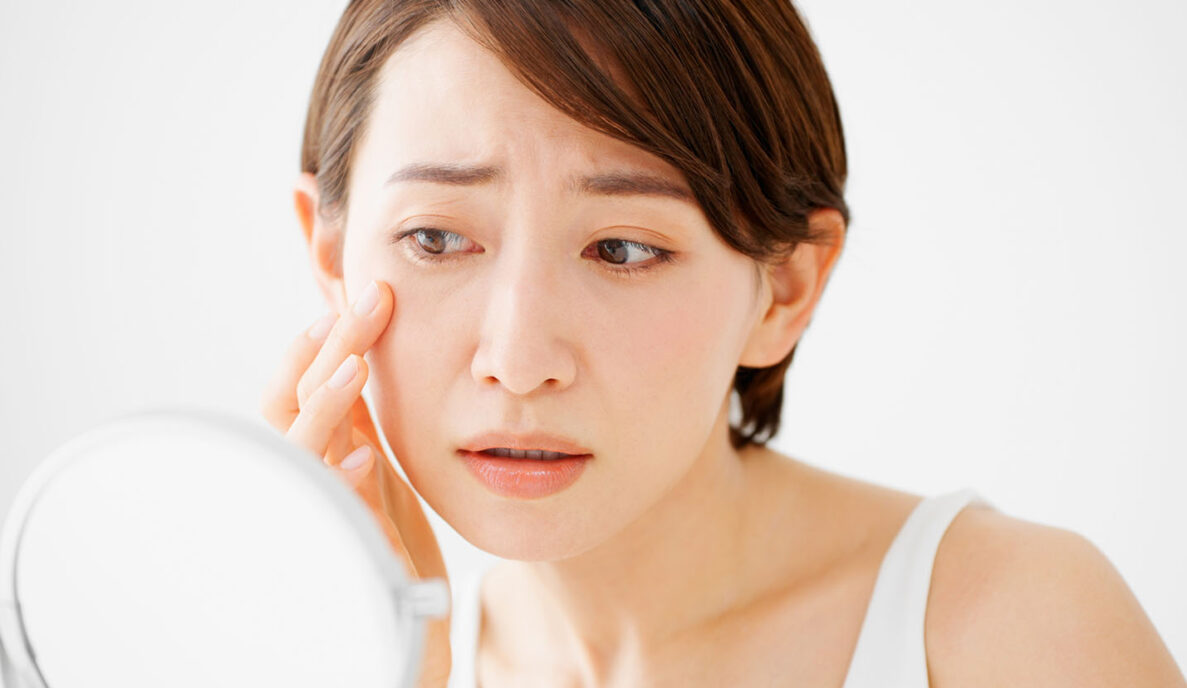 Lady worried about wrinkles