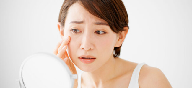 Lady worried about wrinkles